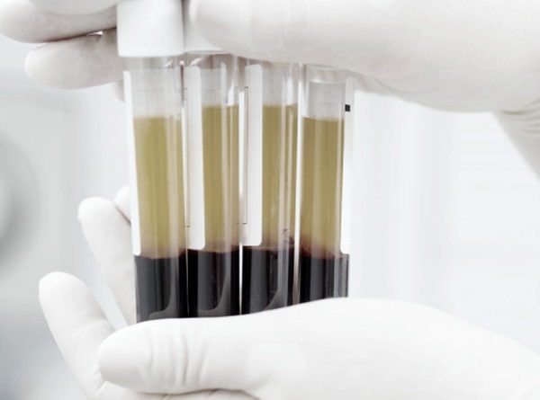 Plasma Enriched Protein Miramar FL